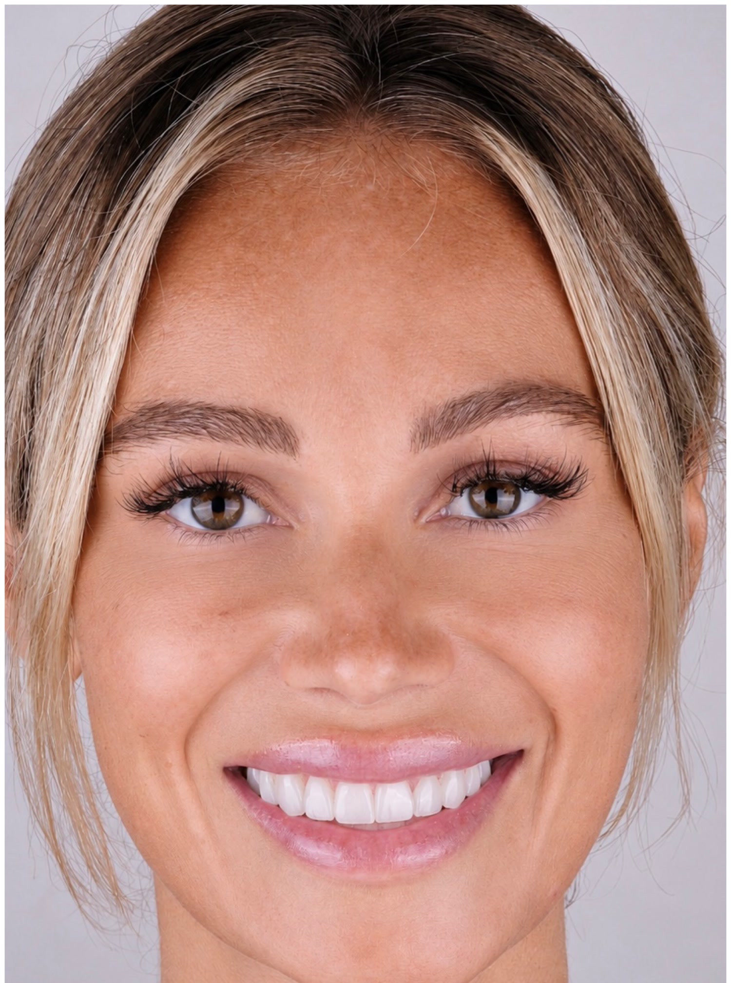 ACE DNTL smile makeover