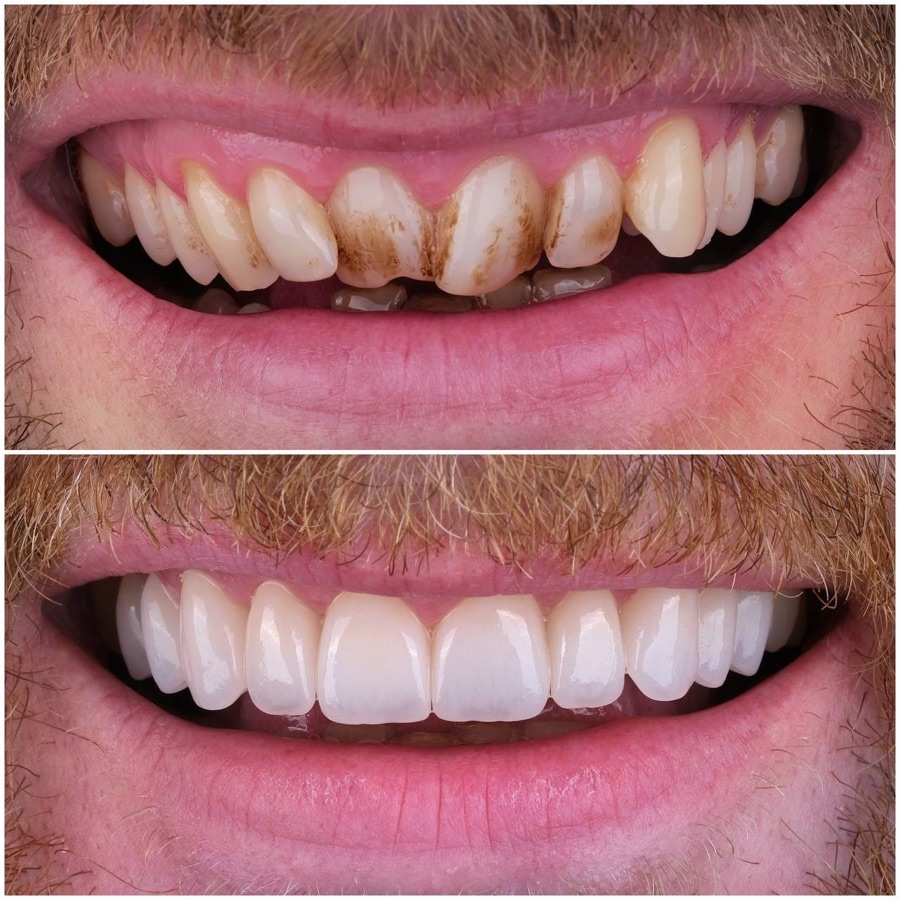 Before and after — full rebuild
