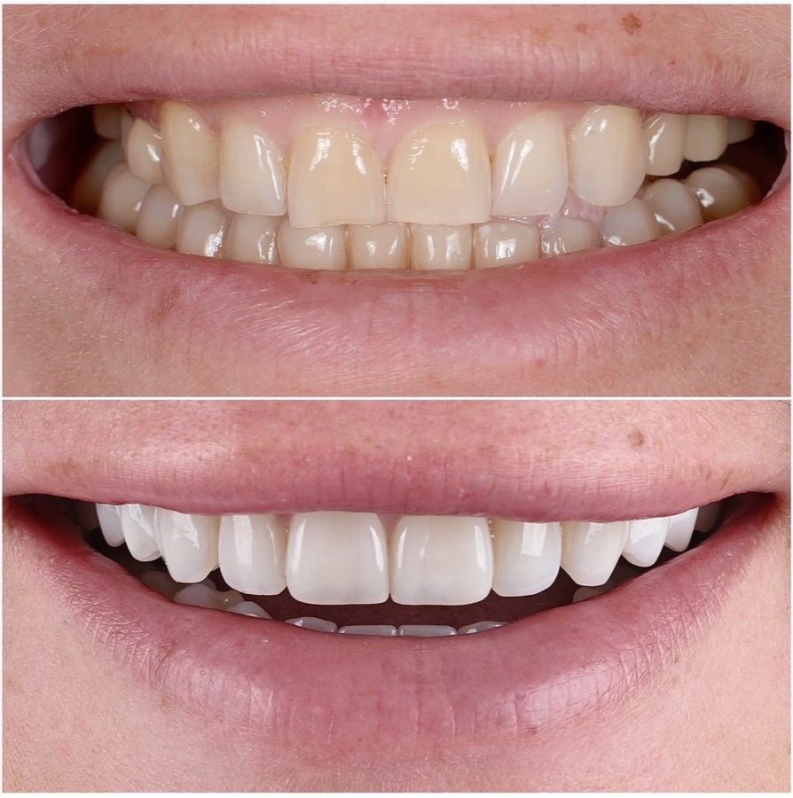 Before and after — soft makeover